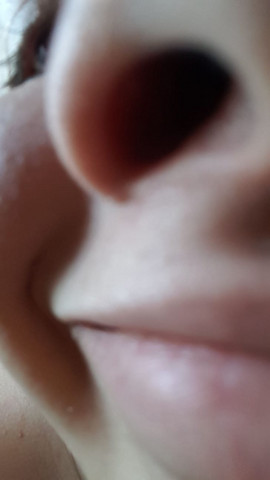Bilder nase von innen VIDEO: Nase