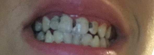 Zahn - (Zähne, Zahnarzt)