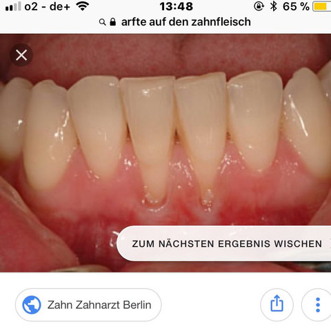 Sind nicht meine Zähne  - (Gesundheit und Medizin, Zahnarzt, Zahnfleisch)