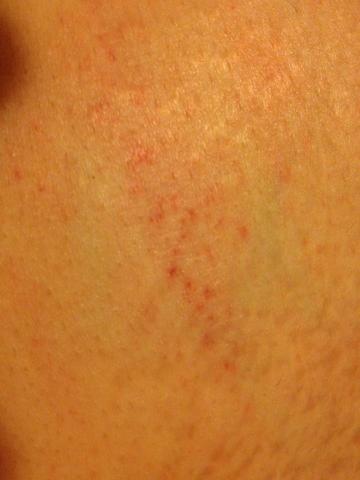- (Schwangerschaft, Bauch)