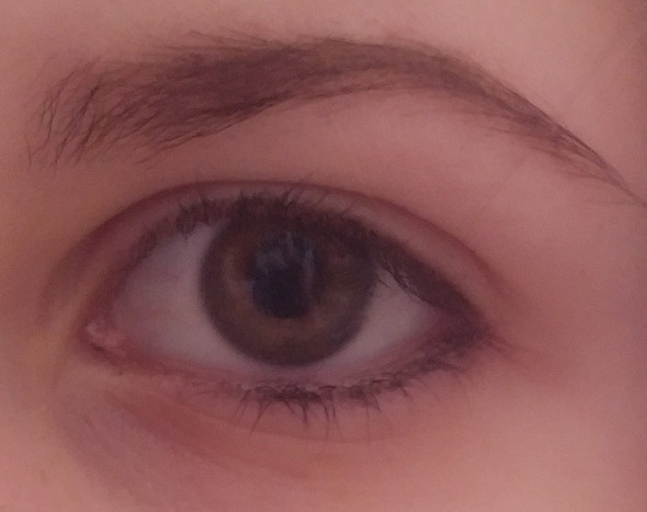 Meinung Zu Schlupflid Schlupflider