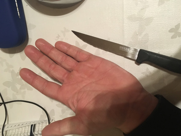 Das Messer  - (Medizin, Verletzung, Nägel)