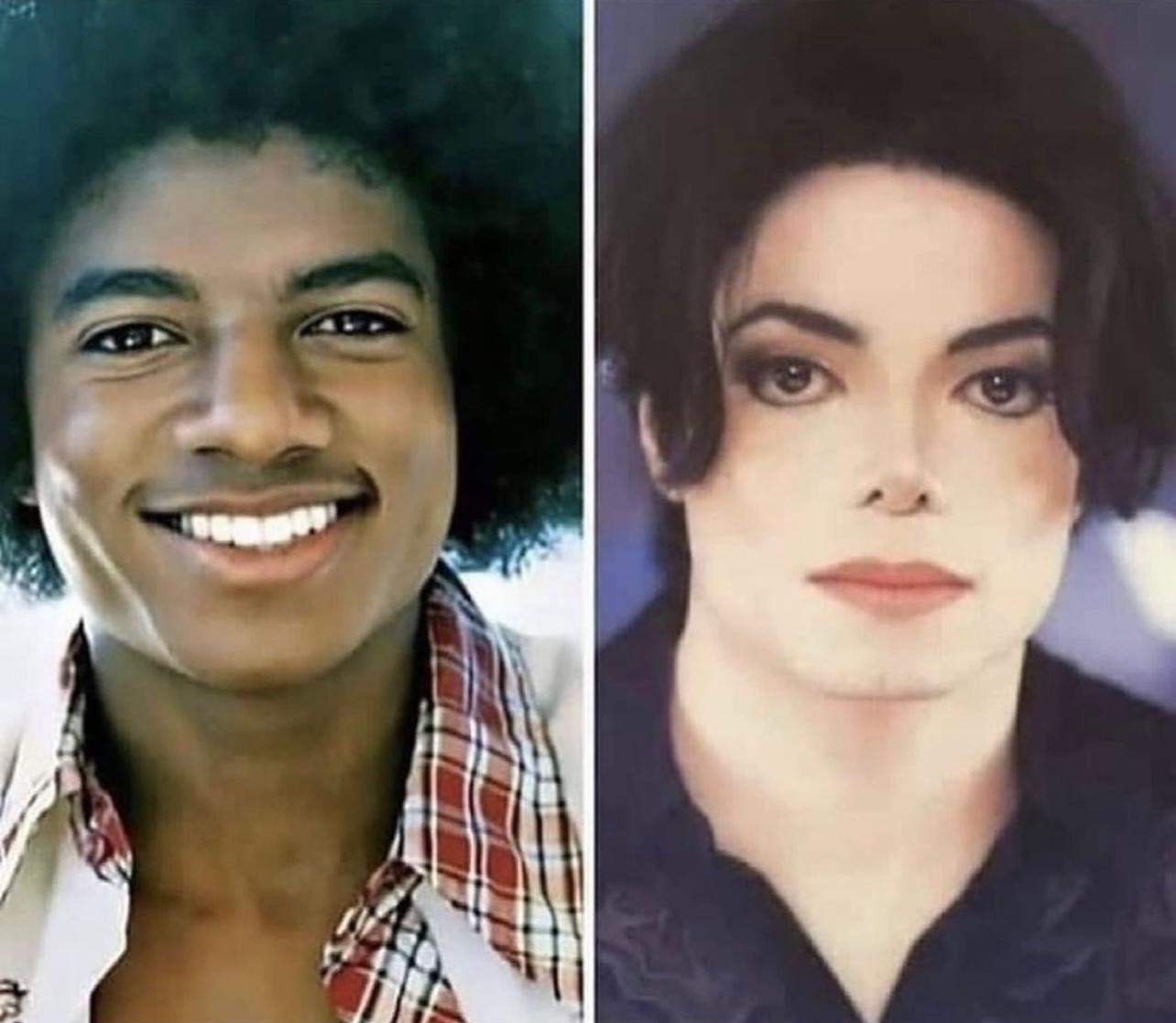 Was steckt hinter Michael Jacksons Entscheidung, weiß zu werden? Was steckt hinter Michael Jacksons Entscheidung, weiß zu werden?