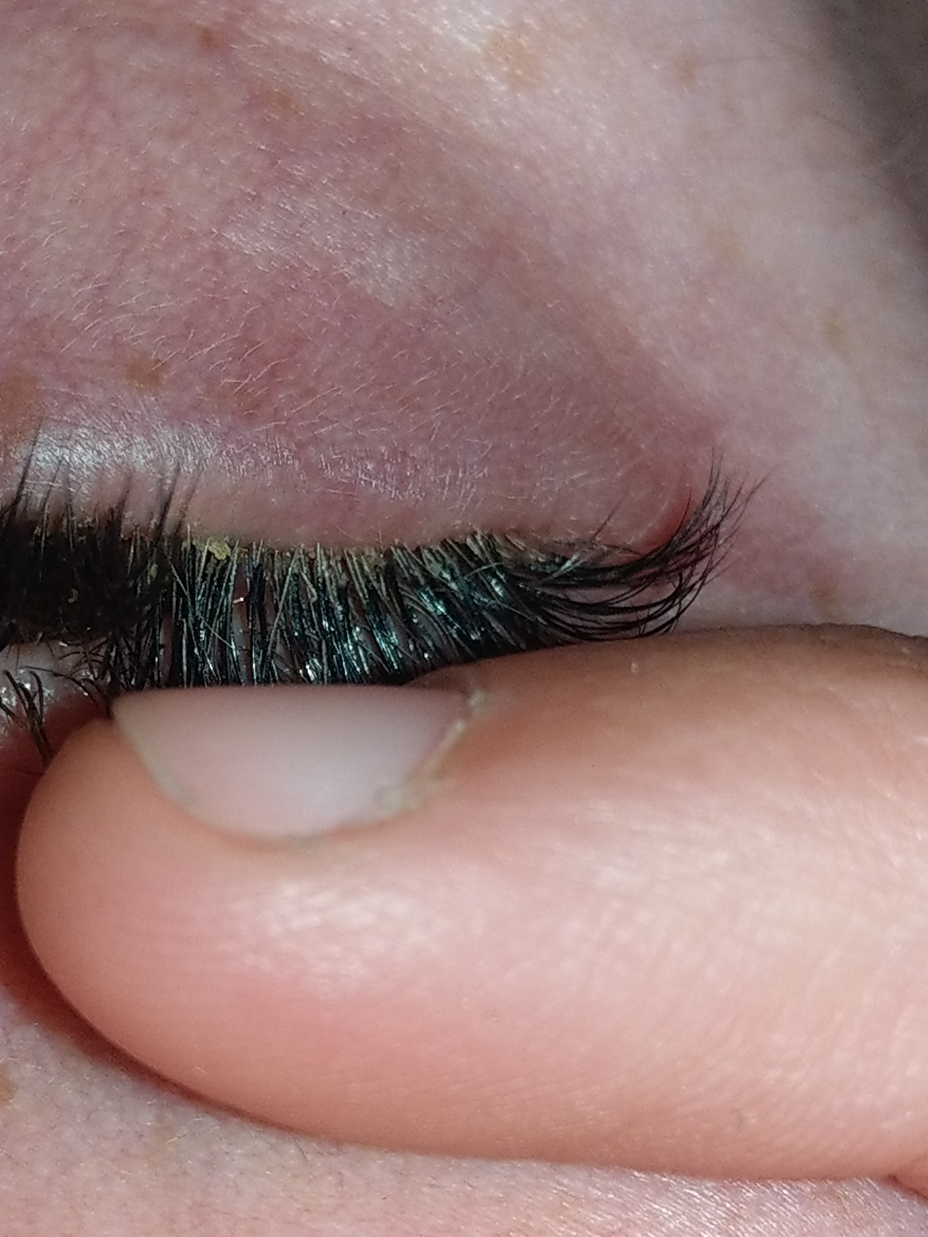 Milben Durch Wimpernverlangerung Gesundheit Augen Wimpern