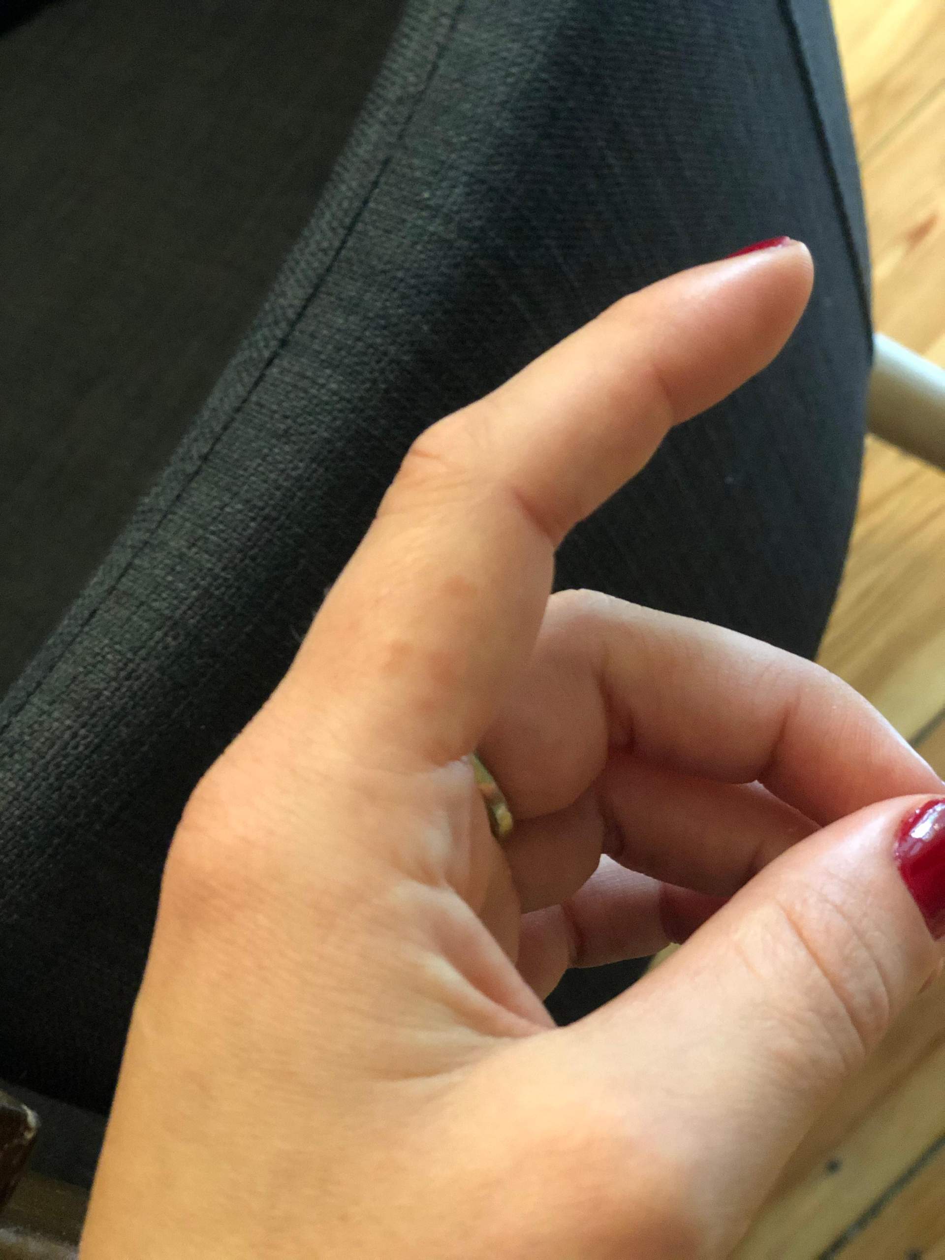 Mini Kaktusstachel unter der Haut? (Gesundheit und Medizin, Medizin, Unfall)