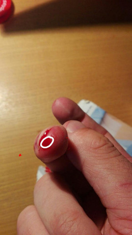 Mit Dieser Wunde Zum Arzt Blut Mit Dieser Wunde Zum Arzt Blut