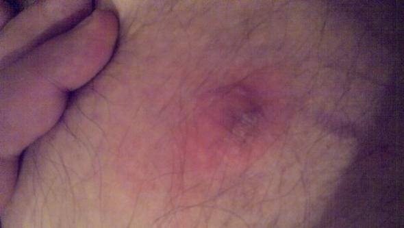 mit foto dunkle harte kugel unter