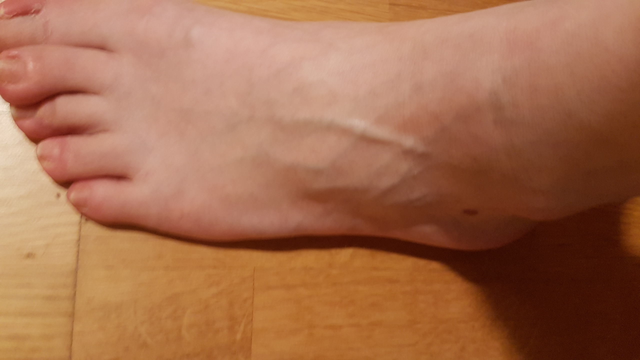 Mit Fuss Umgeknickt Zum Arzt Gesundheit Unfall