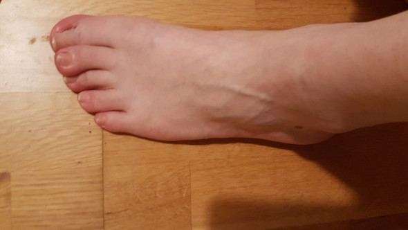 Mit Fuss Umgeknickt Zum Arzt Gesundheit Unfall Mit Fuss Umgeknickt Zum Arzt Gesundheit Unfall