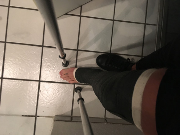 Krücken gipsbein #gipsbein Instagram