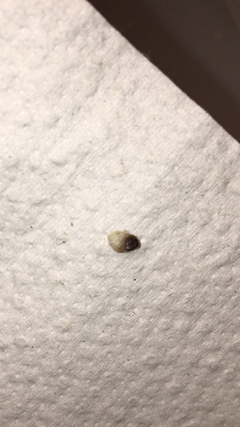 Mitesser Im Intimbereich Pickel Vagina