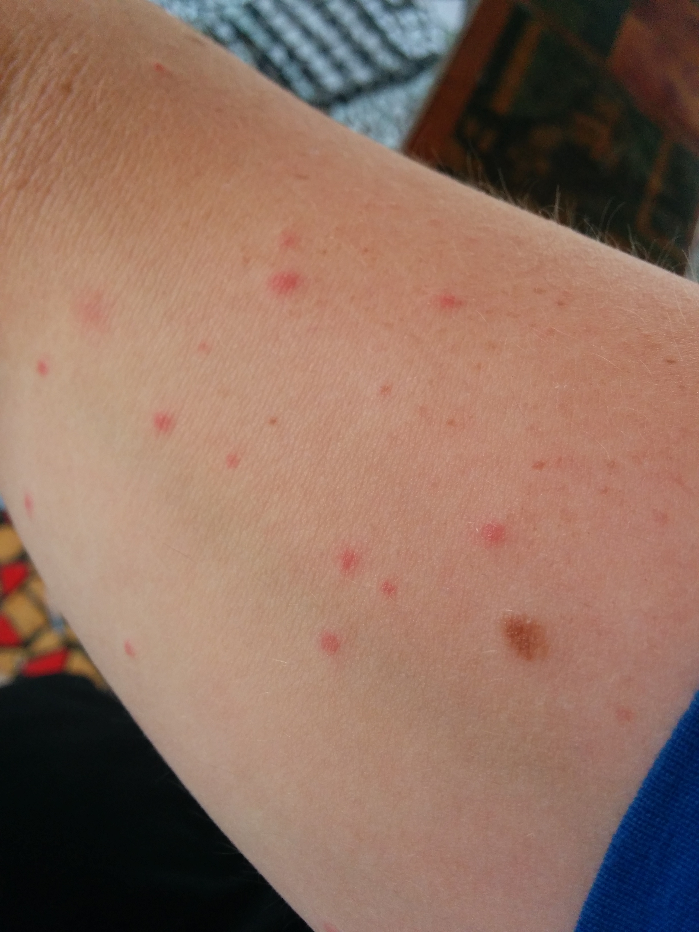 Moskitos oder Flöhe, Costa Rica (biss oder stich)