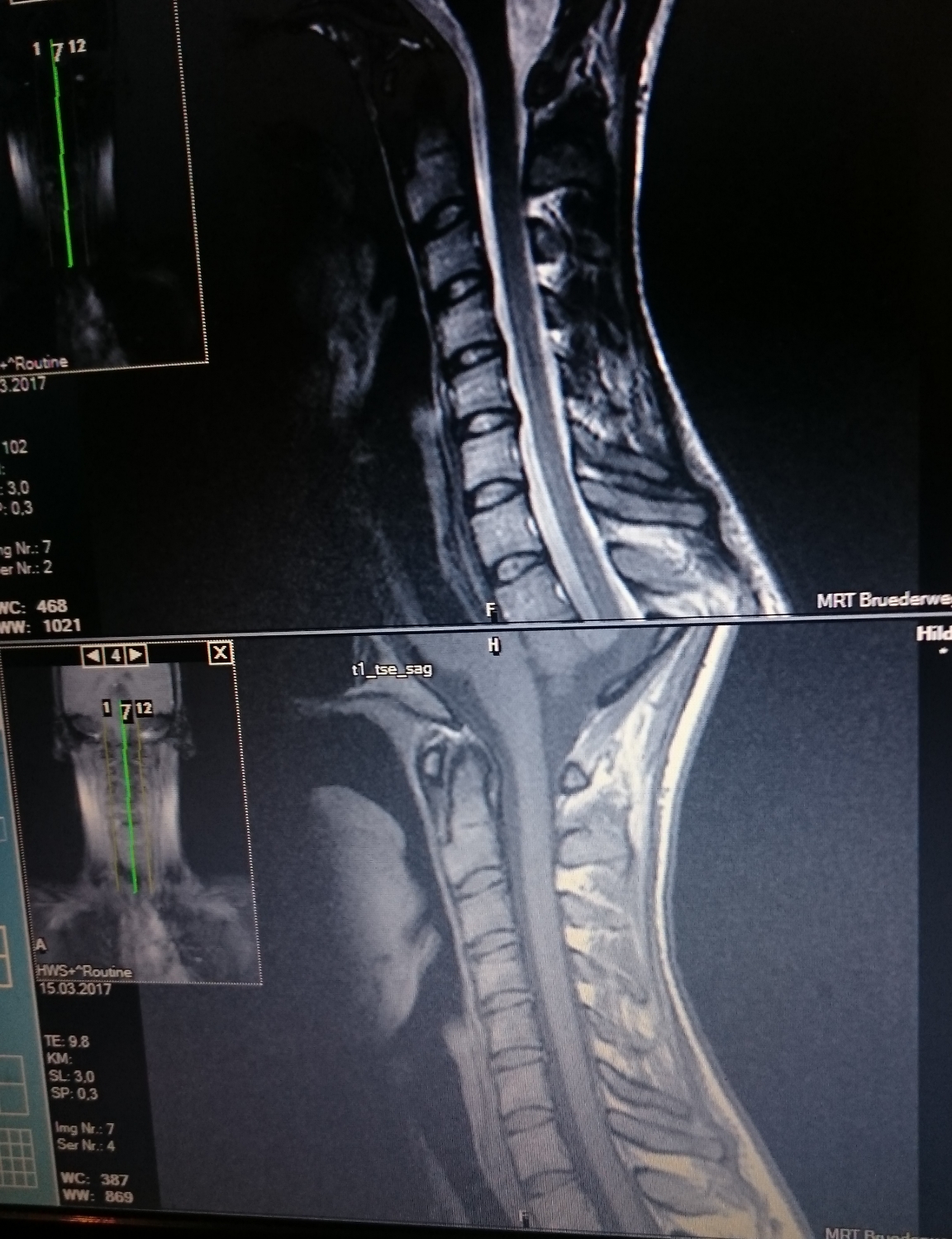 Kann Orthopade Mrt Bilder Auswerten