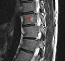Mrt Bilder Was Ist Hier Zu Sehen Tumor Radiologie Mrt Bilder Was Ist Hier Zu Sehen Tumor Radiologie