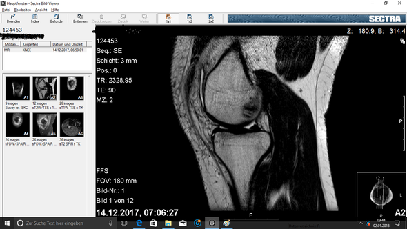 Mrt Bilder Was Ist Kaputt Gesundheit Arzt Knie Mrt Bilder Was Ist Kaputt Gesundheit Arzt Knie