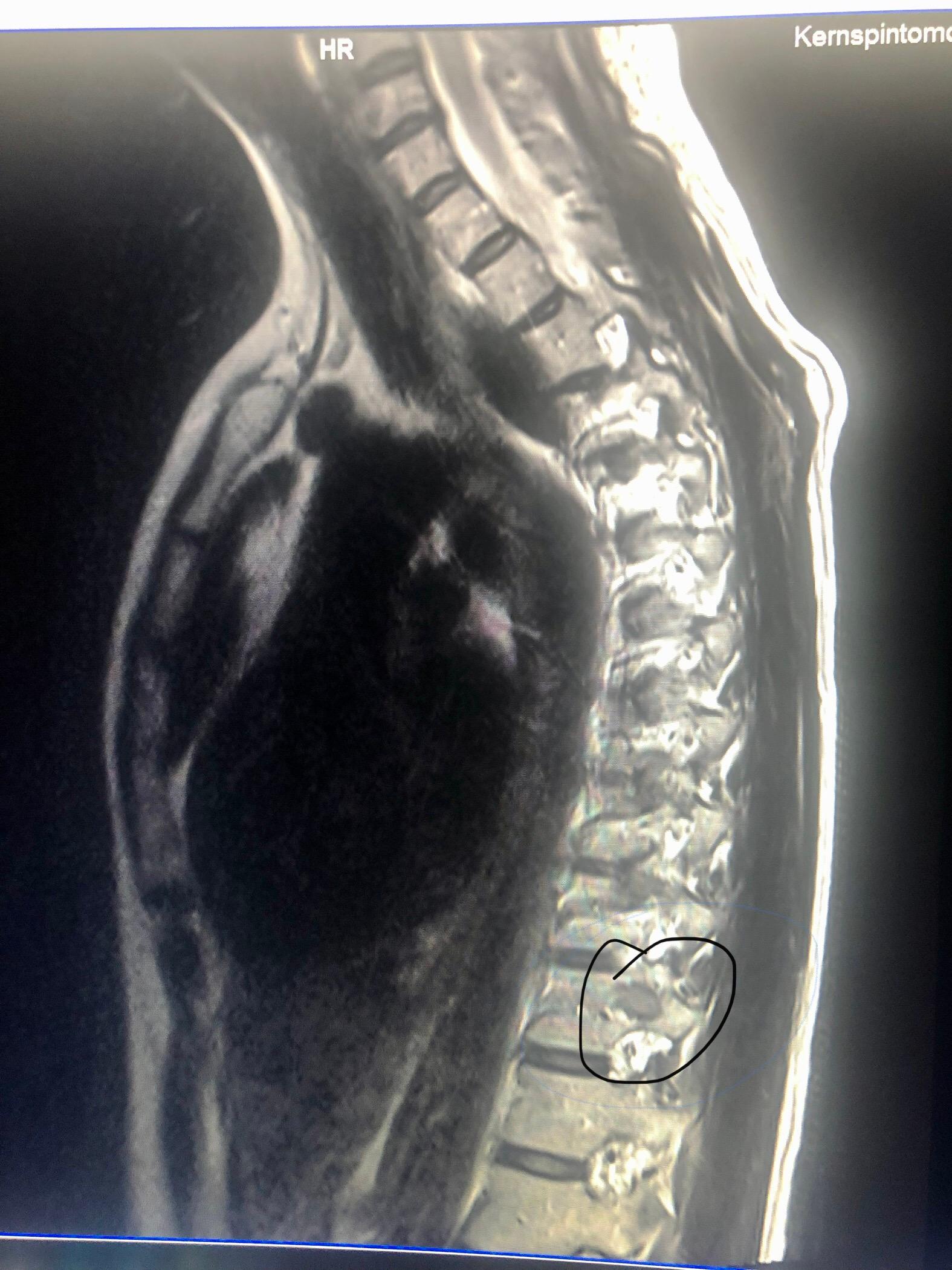 Mrt Bws Computer Gesundheit Und Medizin Ratgeber Mrt Bws Computer Gesundheit Und Medizin Ratgeber