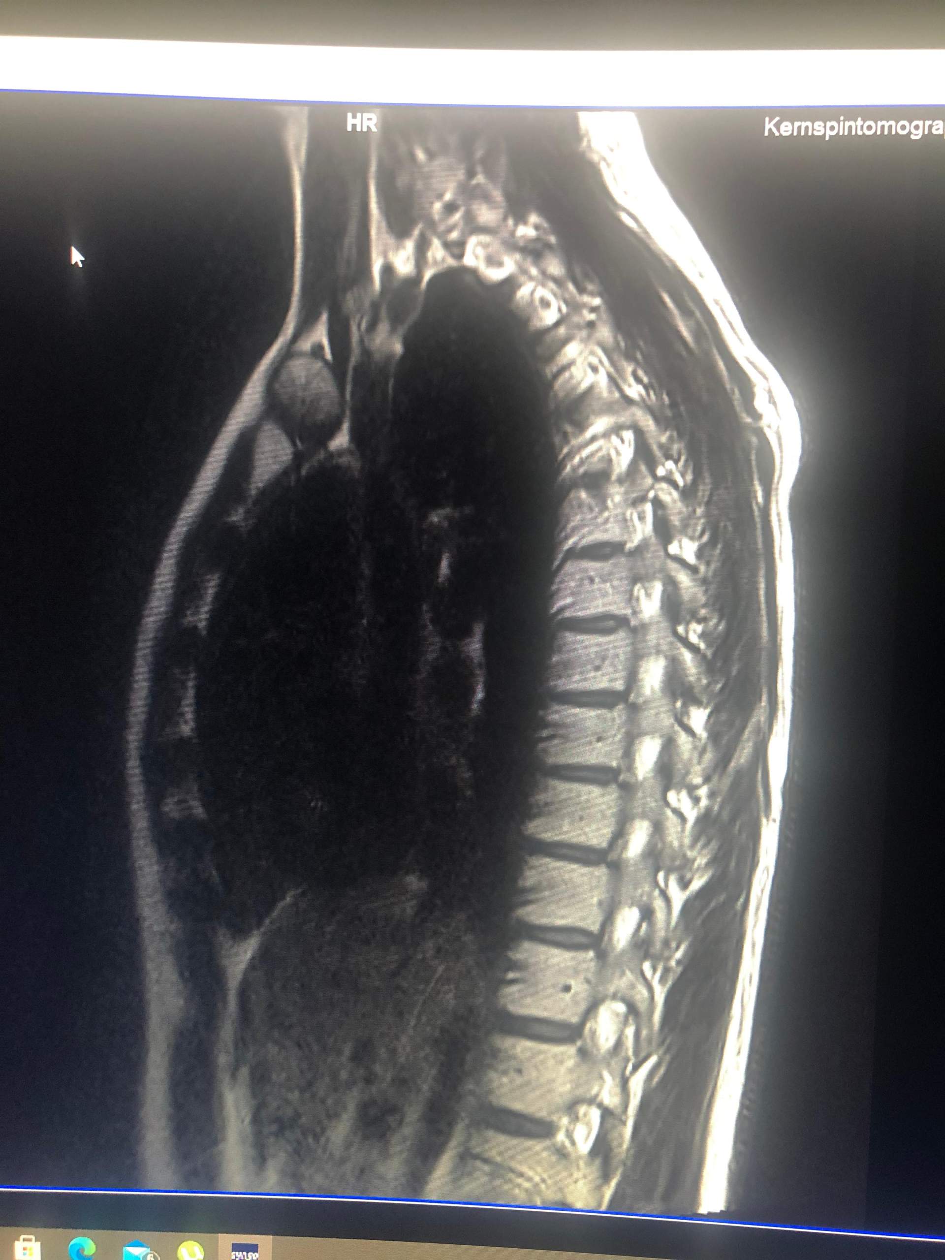 MRT BWS? (Computer, Gesundheit und Medizin, Ratgeber)
