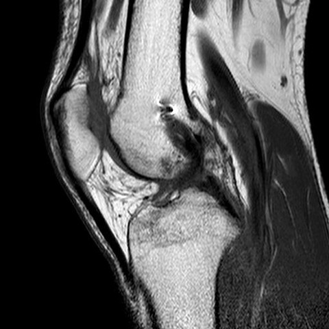Knie6 - (Gesundheit und Medizin, Bilder, Knie)