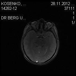 - (Gesundheit, Krankheit)