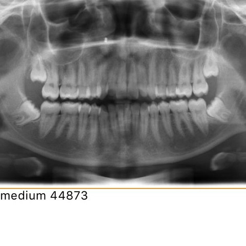 Röntgenbild  - (Gesundheit und Medizin, Zahnarzt, Zahnmedizin)