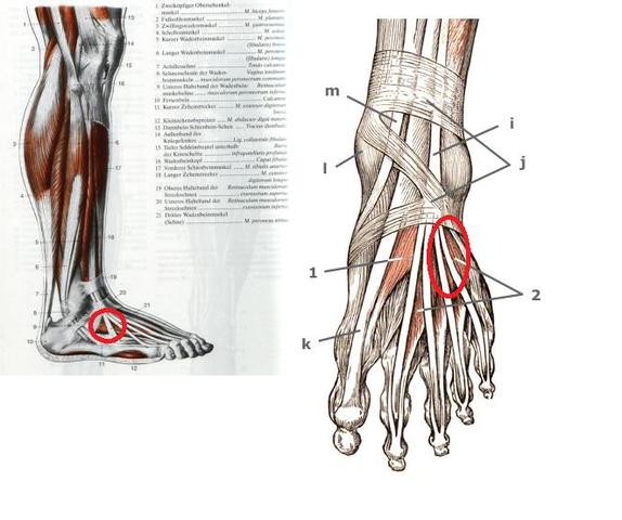 Muskel Knubbel Am Fuss Medizin Arzt Muskeln Muskel Knubbel Am Fuss Medizin Arzt Muskeln