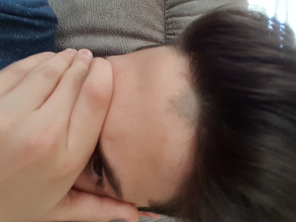 Muss Das Loswerden Aber Wie Haare Rasieren Stirn