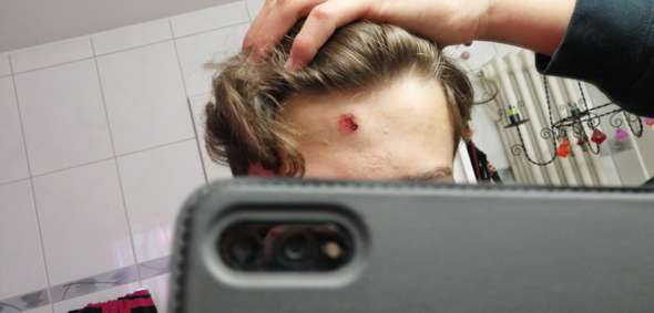 Muss Diese Wunde Noch Genaht Werden Gesundheit Gesundheit Und