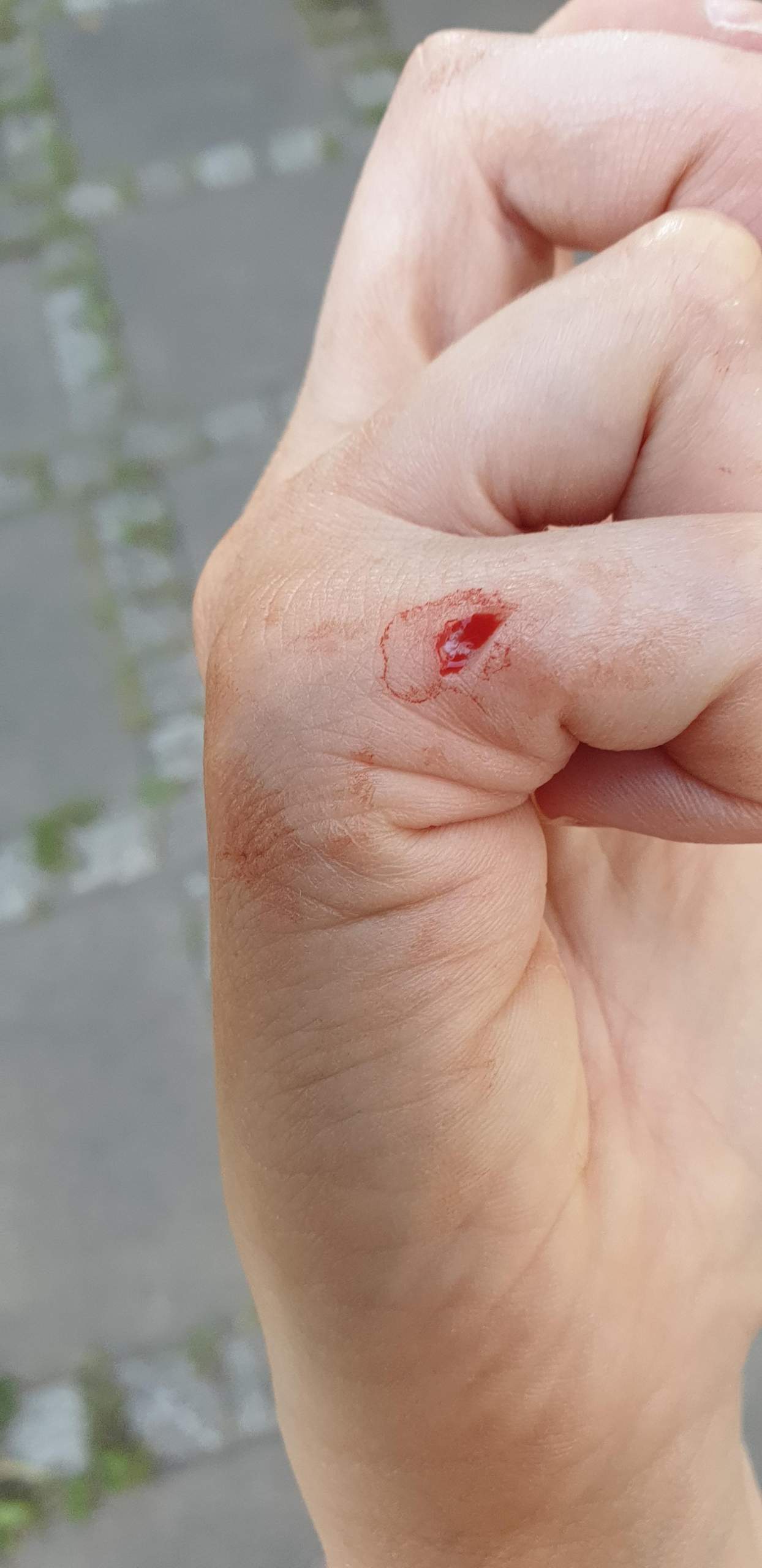Muss Es Genaht Werden 8ich Finger Nahen Muss Es Genaht Werden 8ich Finger Nahen