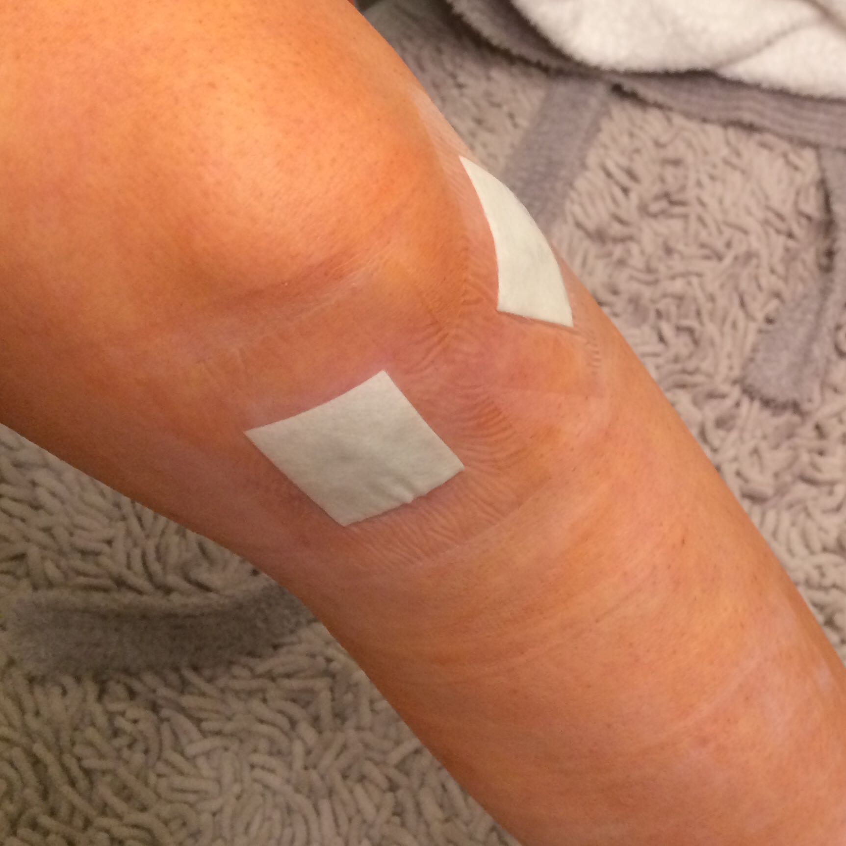 Muss Ich Die Thrombosespritze Uberhaupt Noch Nehmen Thrombose Muss Ich Die Thrombosespritze Uberhaupt Noch Nehmen Thrombose