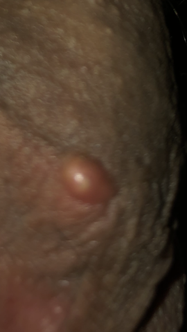 Muss Ich Dringend Zum Notfall Gesundheit Und Medizin Penis Genitalien Muss Ich Dringend Zum Notfall Gesundheit Und Medizin Penis Genitalien