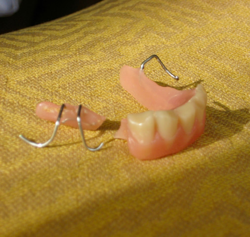 Zahnprothese geht nicht raus