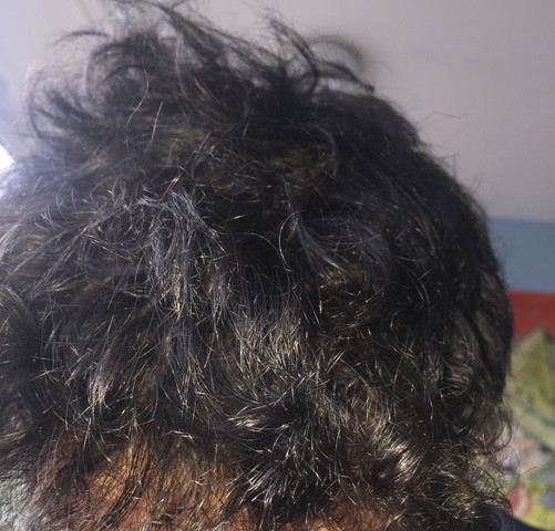 wegen solchen haaren zum hautarzt oder