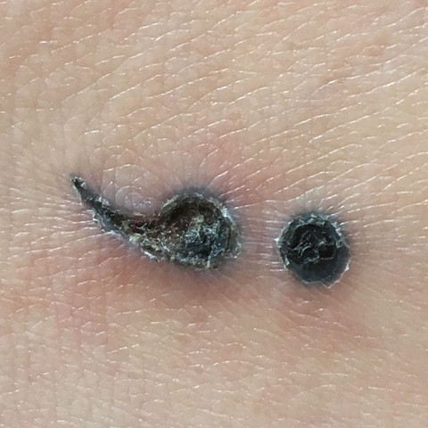 Muss Mein Tattoo Nachgestochen Werden Bzw Ist Da Was Schief Gelaufen Gesundheit Und Medizin Tattoopflege