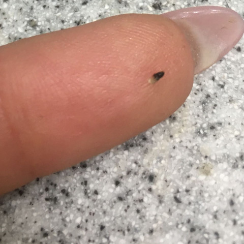 muttermal aus der haut gezogen