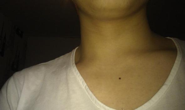 ich - (Arzt, T-Shirt, Narben)