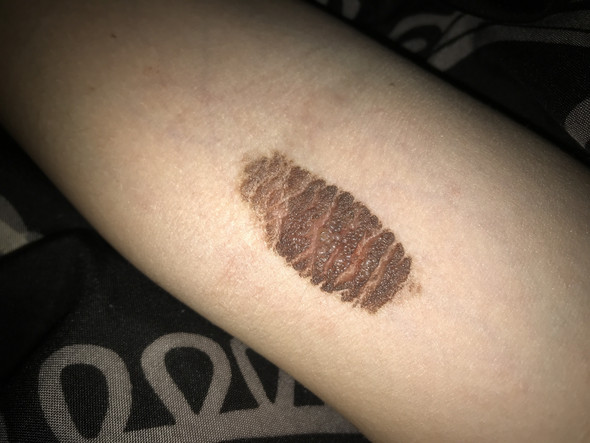 Muttermal Lost Sich Auf Gesundheit Korper Arm Muttermal Lost Sich Auf Gesundheit Korper Arm