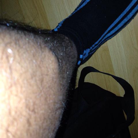 Nach 5 Minuten Sport Bekomme Ich Eine Beule Am Schienbein Arzt Schmerzen Muskeln Nach 5 Minuten Sport Bekomme Ich Eine Beule Am Schienbein Arzt Schmerzen Muskeln