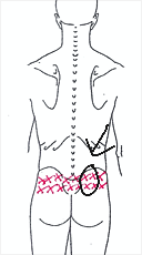 Nach Der Arbeit Schmerzen Am Po Bereich Kaum Bewegung Moglich Bild Arzt Hufte Nach Der Arbeit Schmerzen Am Po Bereich Kaum Bewegung Moglich Bild Arzt Hufte