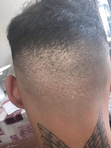 donor bereich schlimm