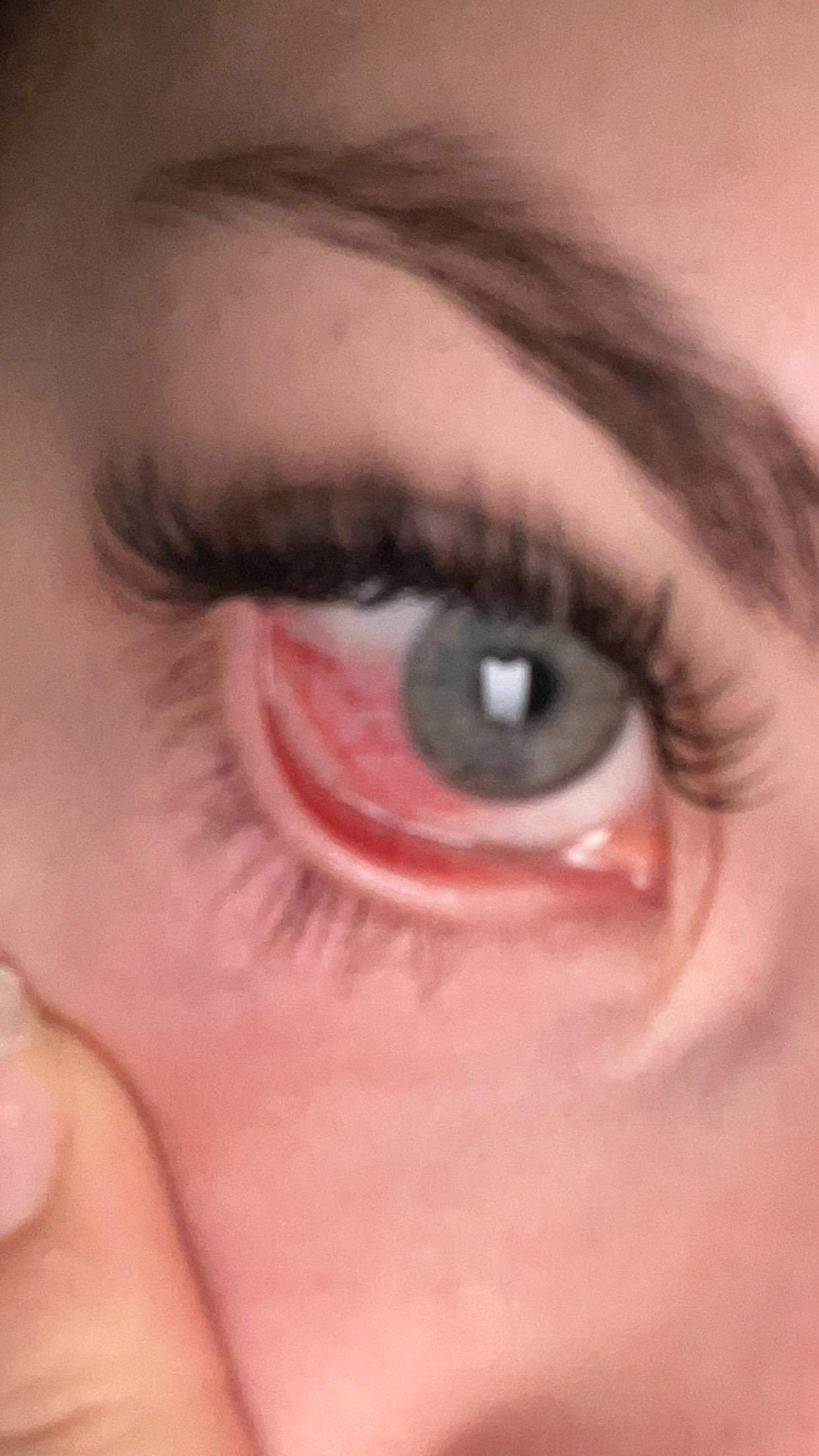 Nach Wimpernverlängerung Auge tut weh und rot? (Schmerzen, Augen, Wimpern)
