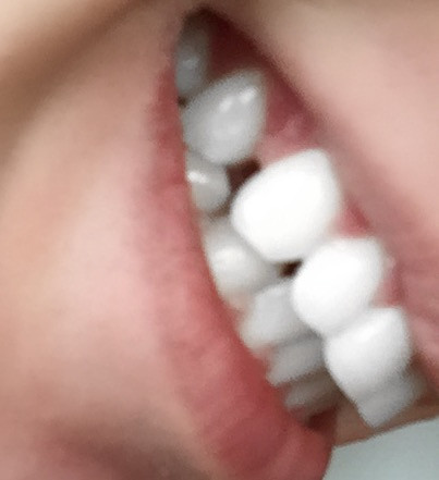 Meine Lücke - (Medizin, Arzt, Zähne)