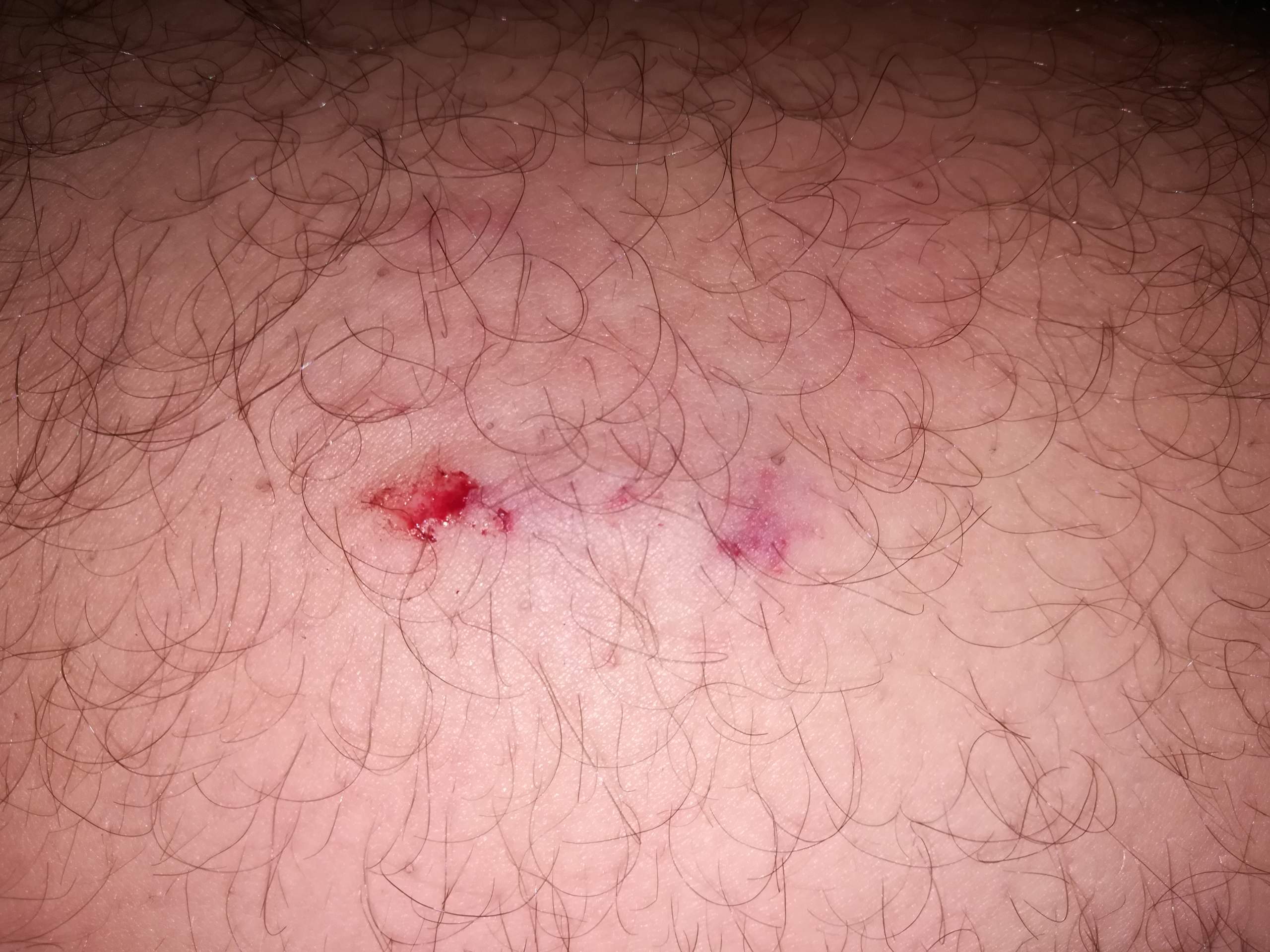Nachbarshund hat mich gebissen, was tun? (Hund, Hundebiss)