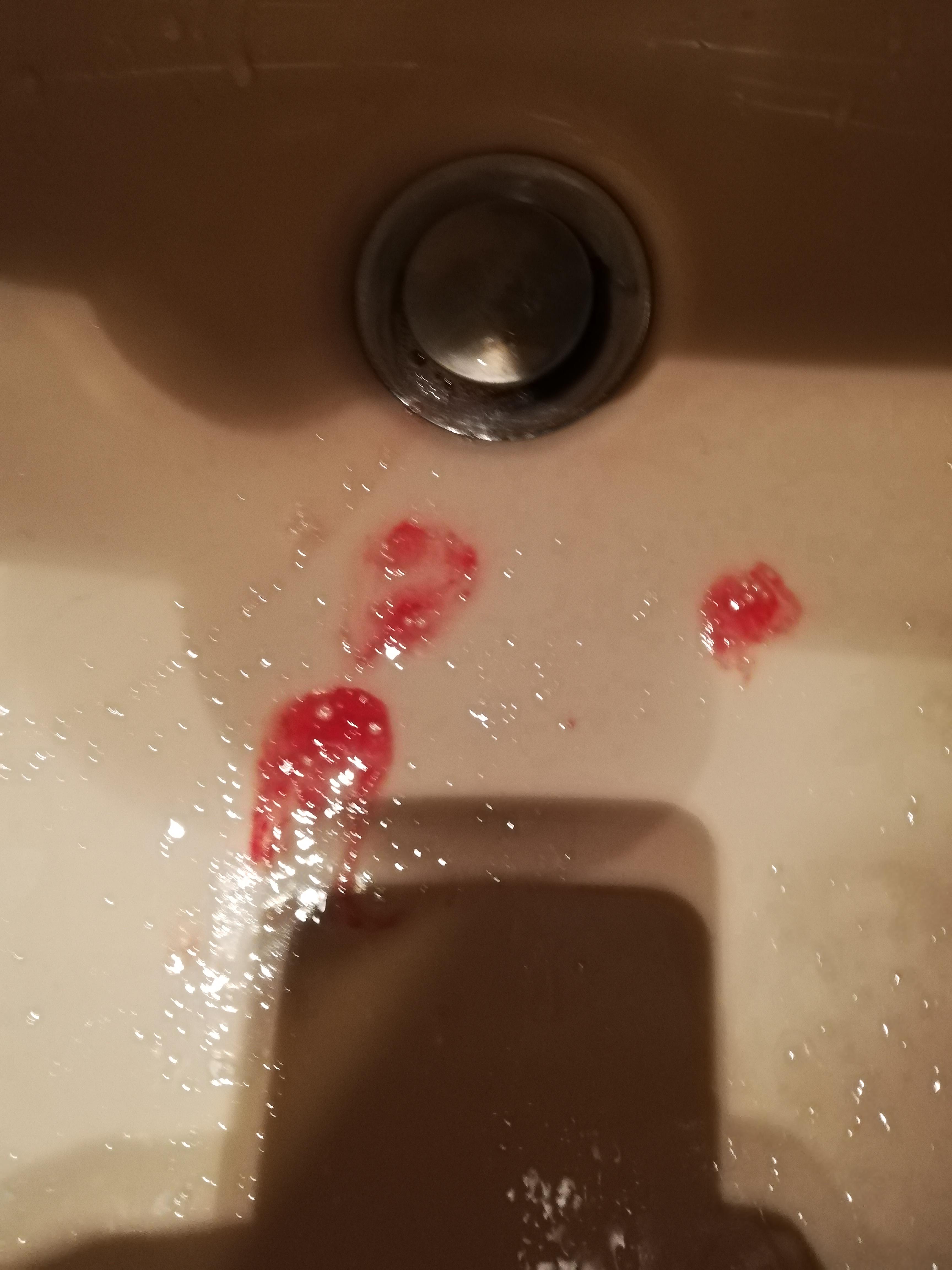 Nachts aufgewacht und Blut gehustet, Arzt? (Gesundheit und Medizin, krank, Husten) Nachts aufgewacht und Blut gehustet, Arzt? (Gesundheit und Medizin, krank, Husten)
