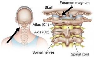 Nackenschmerzen Mit Knirschen Gerausche Wie Reiben Bei Der Atlas Bereich C1 Gesundheit Und Medizin Gesundheit Medizin Nackenschmerzen Mit Knirschen Gerausche Wie Reiben Bei Der Atlas Bereich C1 Gesundheit Und Medizin Gesundheit Medizin