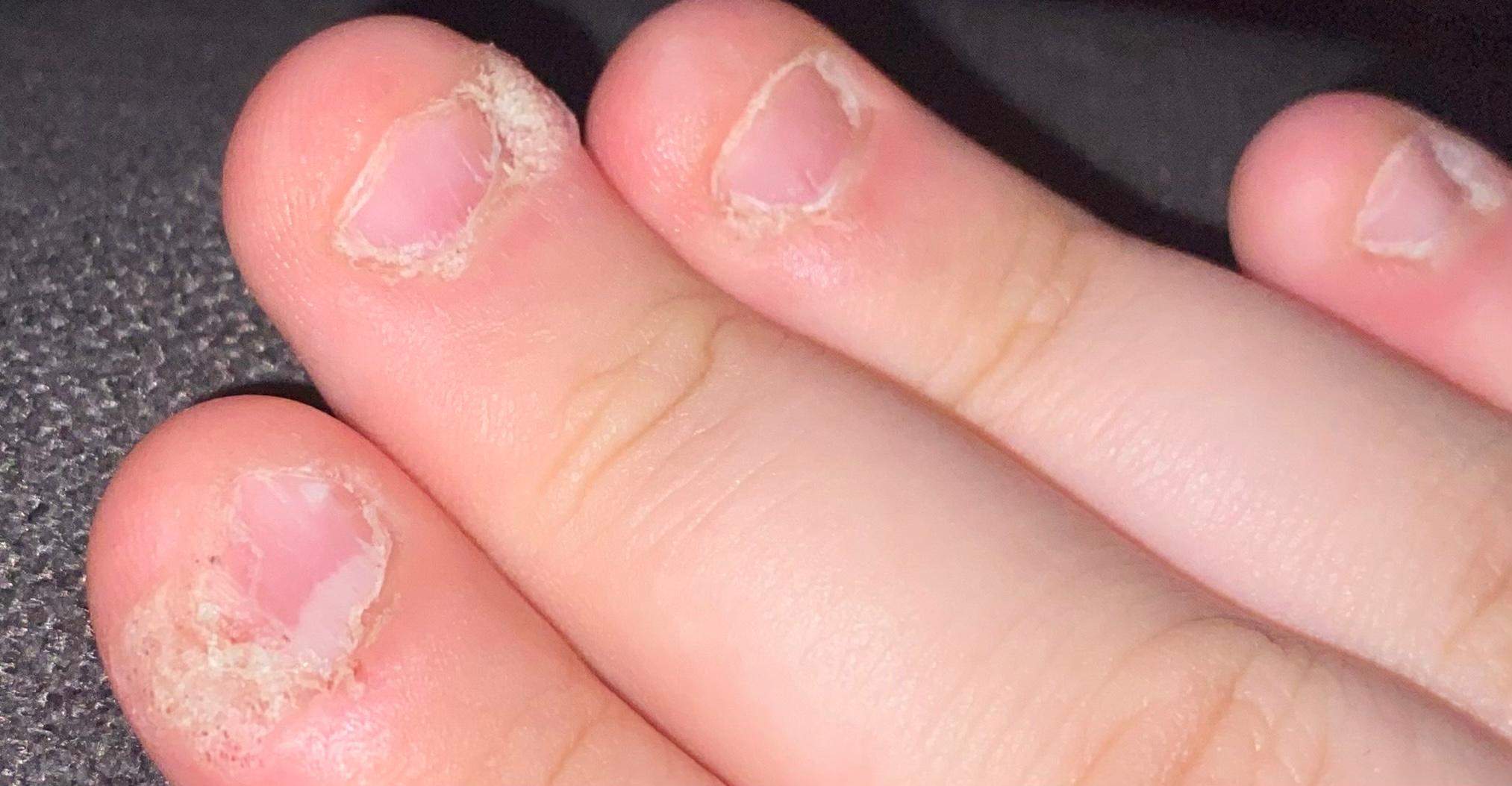 Ngel? (Hand, Nagellack, Fingerngel)