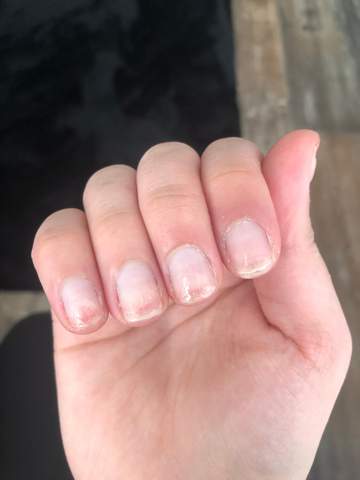 nagel kaputt durch frasen beauty