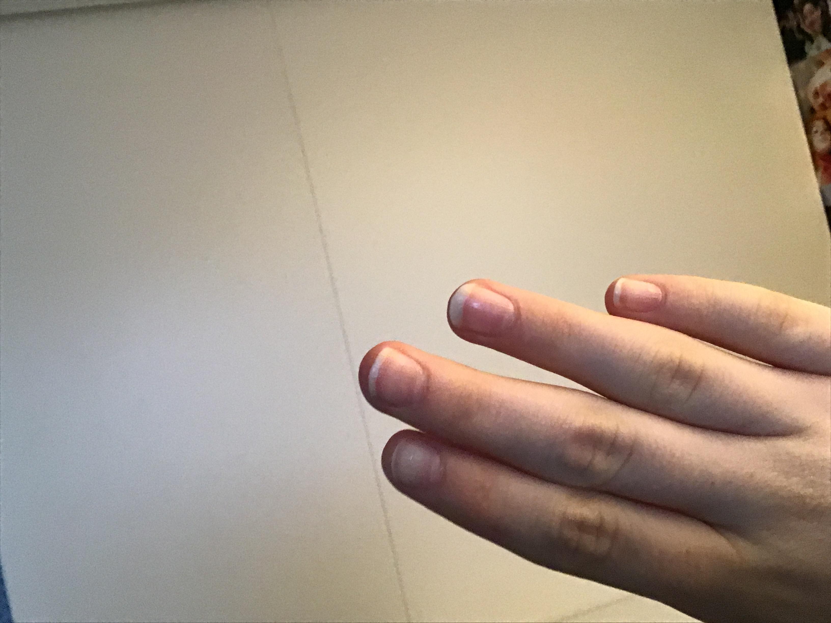 Nagel Ungleichmassig Beauty Nagellack Fingernagel
