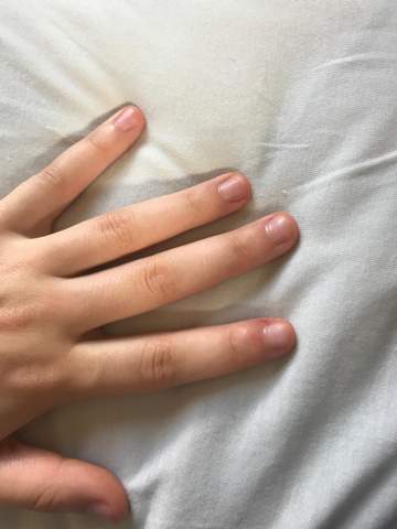 Nagel Wachsen Nicht Mehr Beauty Fingernagel Fingernagel Kauen