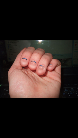 Nagelkaueeen Aufhoren Nagelkauen Nagelkaueeen Aufhoren Nagelkauen