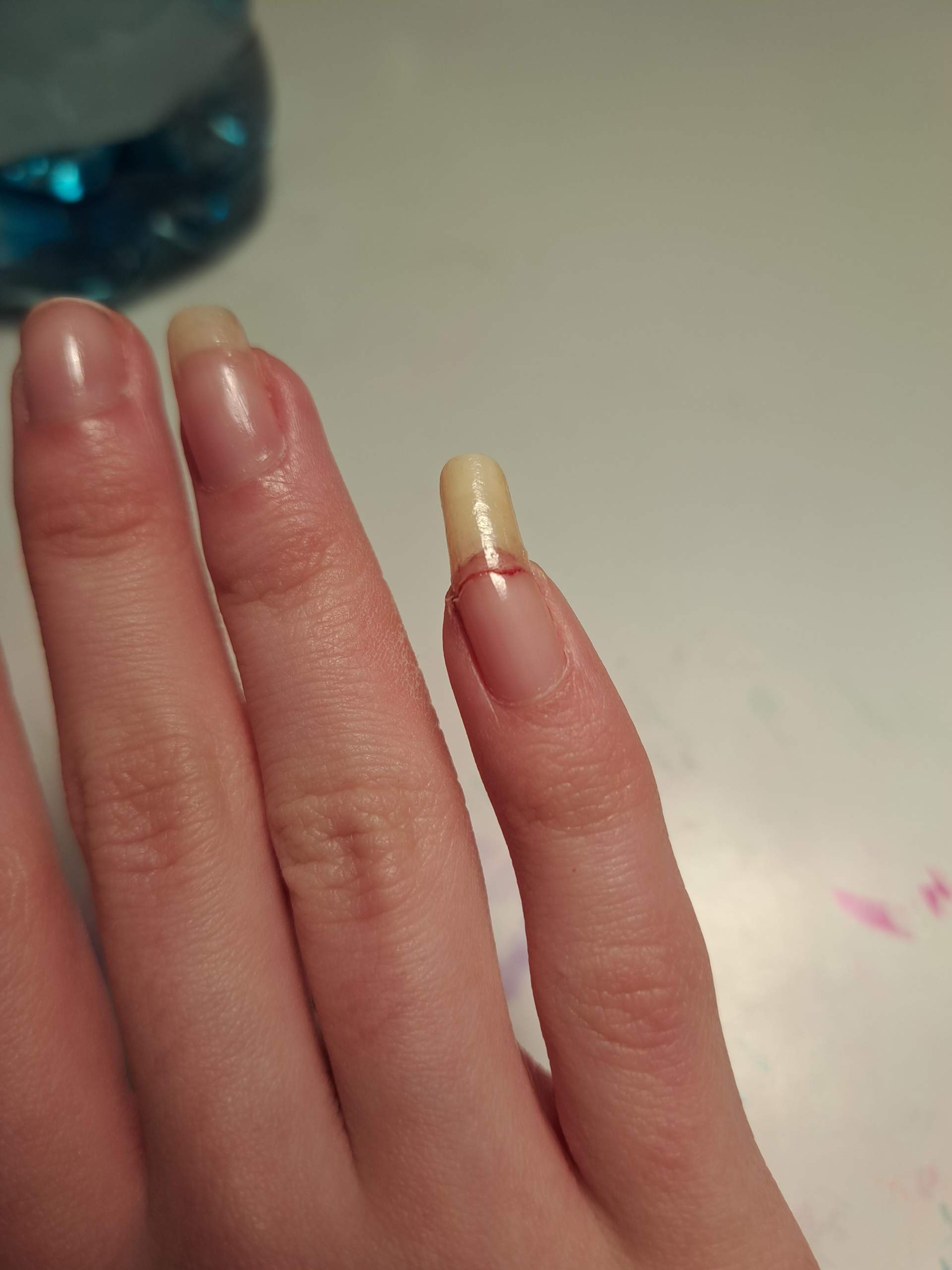 Nagel ist eingerissen was tun? (Nägel, Finger, Fingernägel)